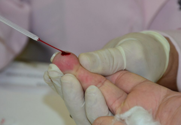 Saúde promove ação de verão para prevenção de ISTs em João Pessoa